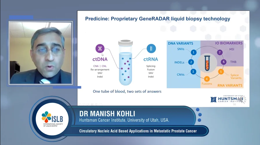 Circulatory Nucleic Acid Based Applications in Metastatic Prostate Cancer